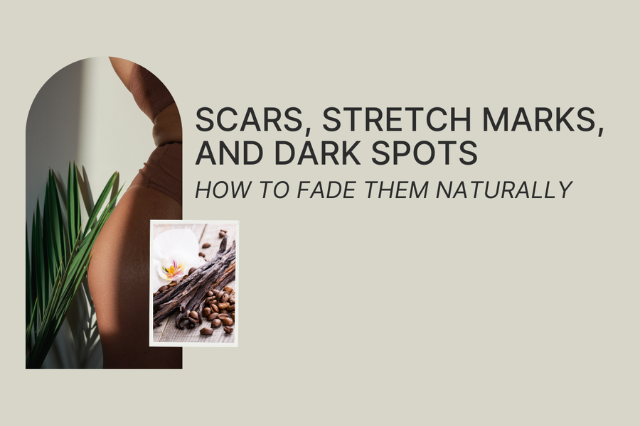 Scars, Stretch Marks, and Dark Spots: How to Fade Them Naturally